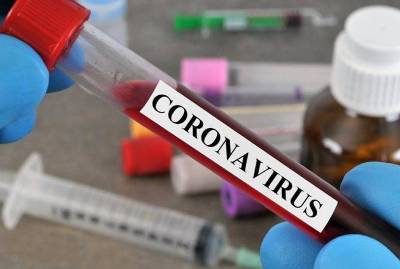 L’Arménie recensait ce lundi matin 482 malades du coronavirus