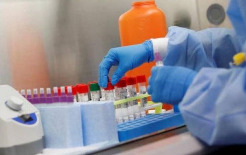 L’Arménie a importé de Chine un stock de 100 000 tests du coronavirus