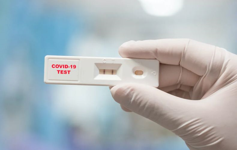 L’Arménie produit des appareils de tests du coronavirus et les premiers vont être livrés aujourd’hui