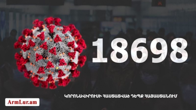 665 cas nouveaux d’infection au coronavirus hier en Arménie avec un total de 18 698 patients infectés