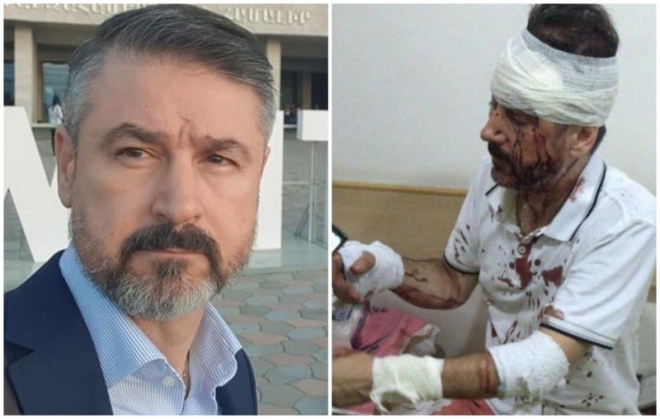 Parmi les centaines d’Arméniens blessés Ara Haladjian un miraculé de l’explosion de Beyrouth