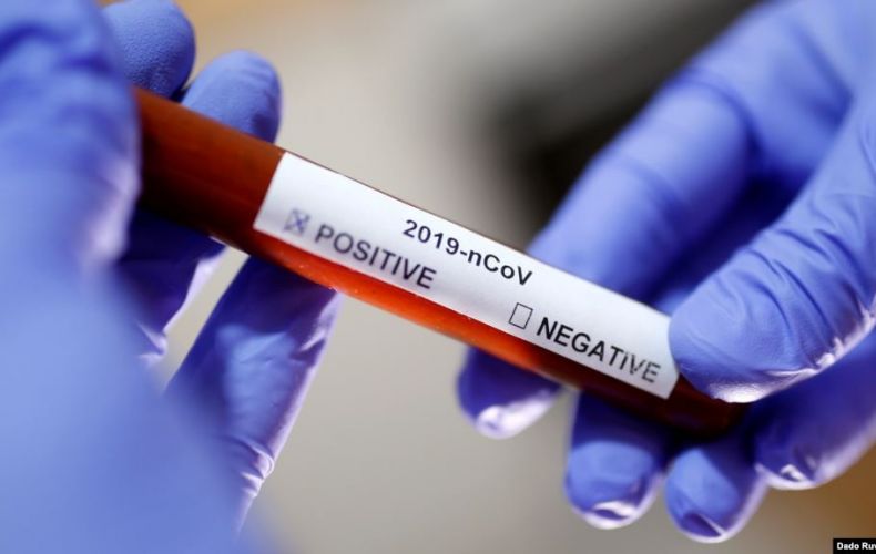 9 nouveaux cas de coronavirus ont été enregistrés en Artsakh