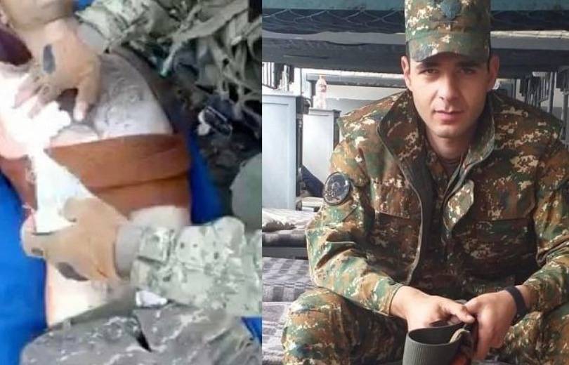 L&rsquo;Azerbaïdjan a remis les corps de 95 militaires Arméniens à l&rsquo;Arménie dont certains torturés en captivité