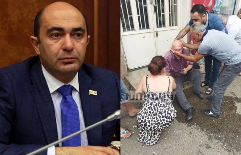 Au Haut-Karabakh, des personnes s&rsquo;évanouissent chaque jour à cause de la malnutrition affirme Edmon Marukyan
