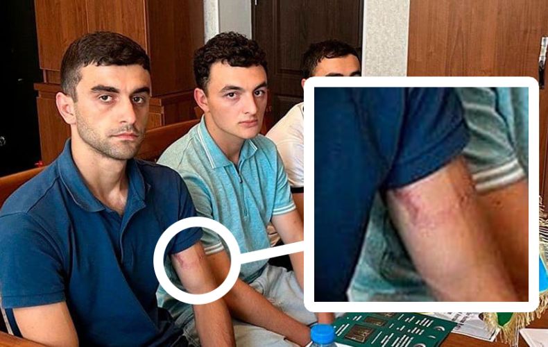 Les 3 jeunes Arméniens enlevés par l’Azerbaïdjan au corridor de Latchine ont ont été victimes de violences par les Azéris
