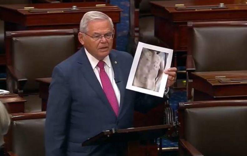 Le blocus de l&rsquo;Artsakh par l&rsquo;Azerbaïdjan présente des signes de génocide affirme le sénateur américain Bob Menendez