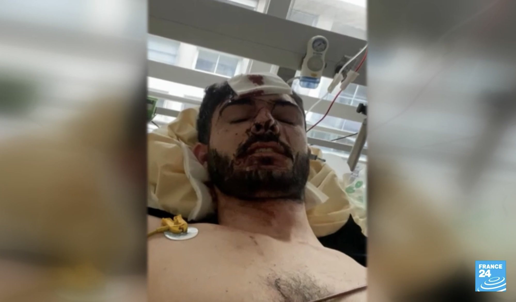 Tortures en Azerbaïdjan : s&rsquo;il vous plait regardez ceci