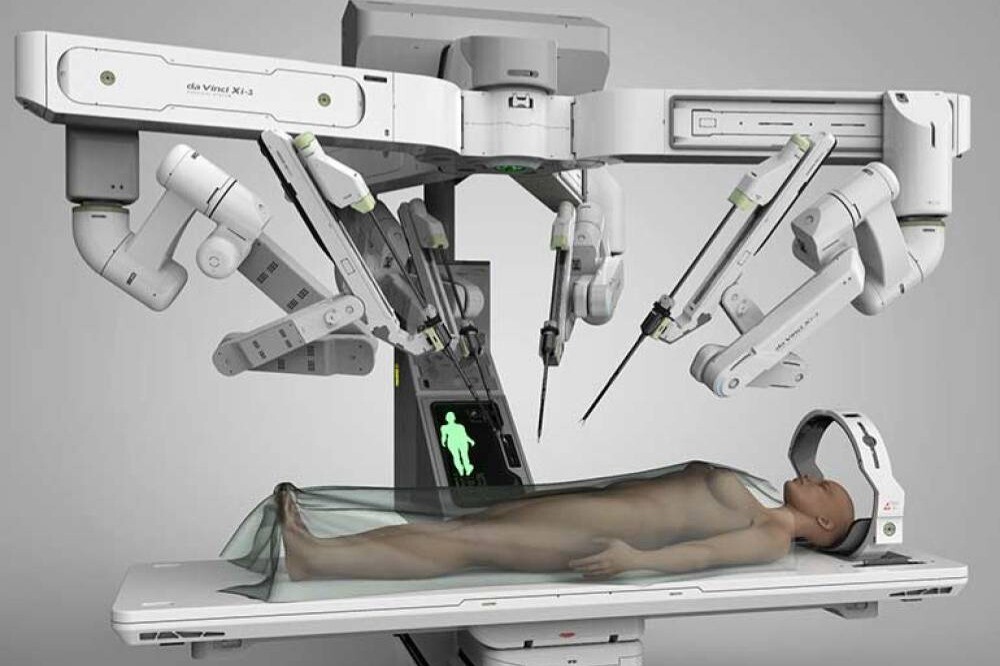 La première opération chirurgicale robotisée a été réalisée en Arménie